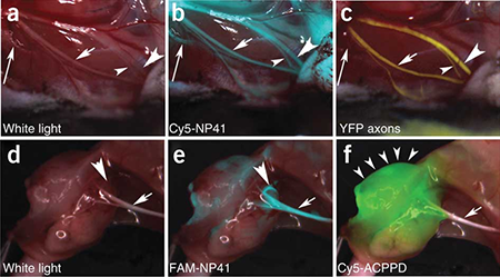 center-fgs-nguyen-glowing-nerves.png