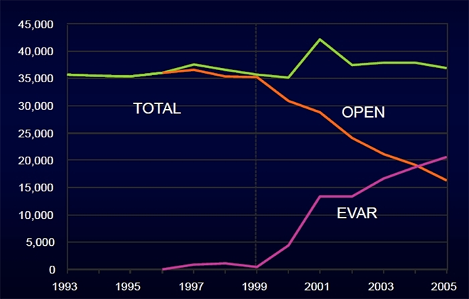 Figure 2. EVAR Exceeds Open Repair in the United States in 2004